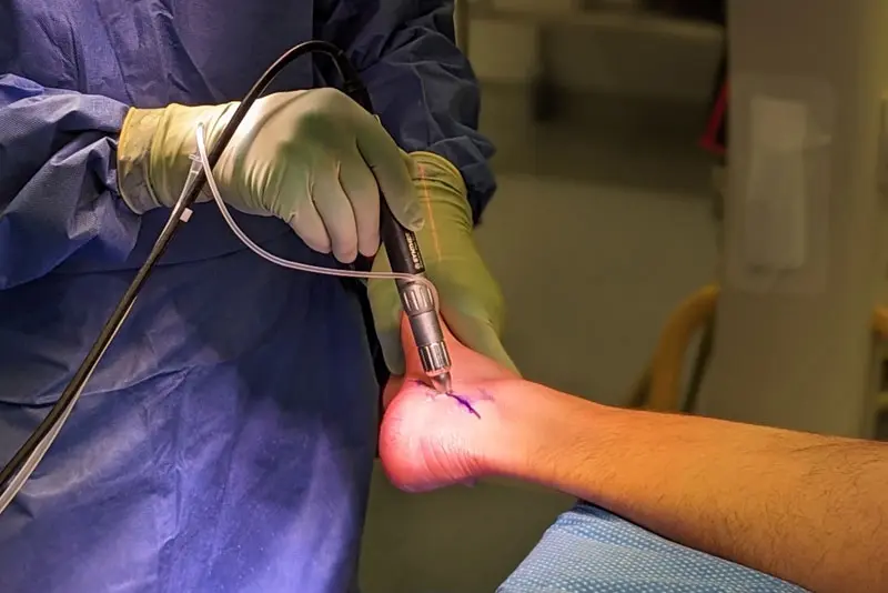 North Bristol Private Hospital - Novel Minimally Invasive Surgery