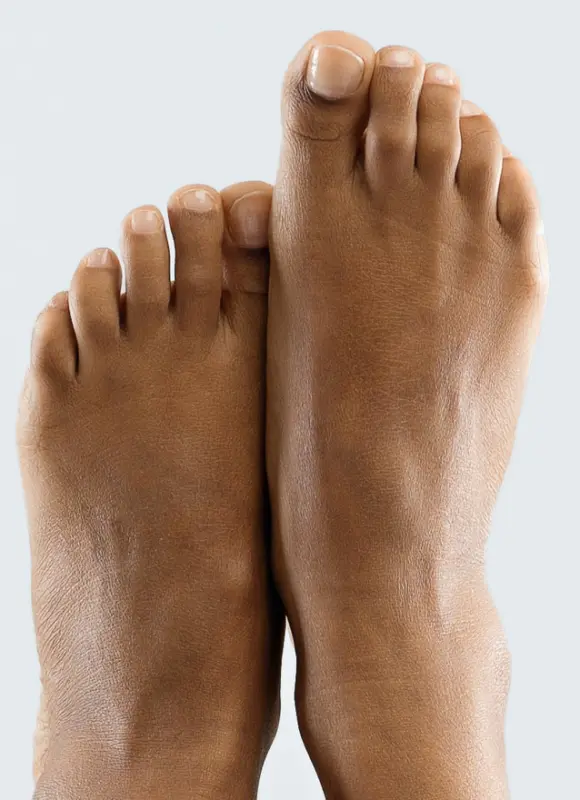 North Bristol Private Hospital - Foot & Ankle Surgery